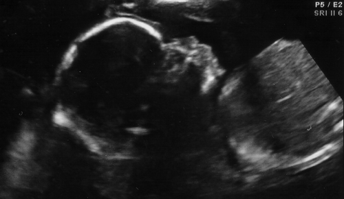 Howeberry, Lisa Howe, ultrasound photo, baby